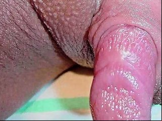 XHamster Porno - Worlds Biggest Clit Free Funny Porn Video 8b Xhamster